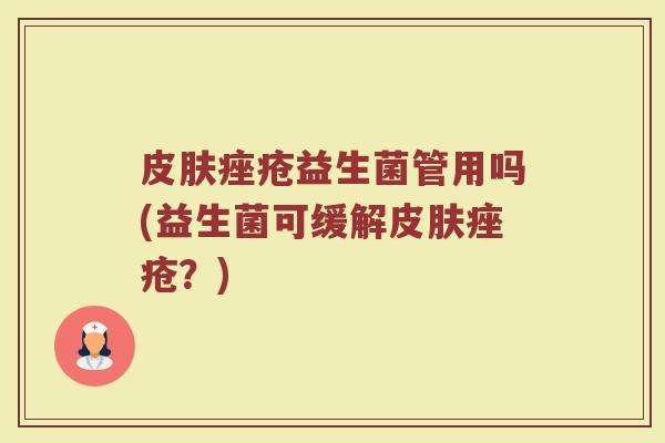 益生菌管用吗(益生菌可缓解?) 益生菌管用吗(益生菌可缓解?)