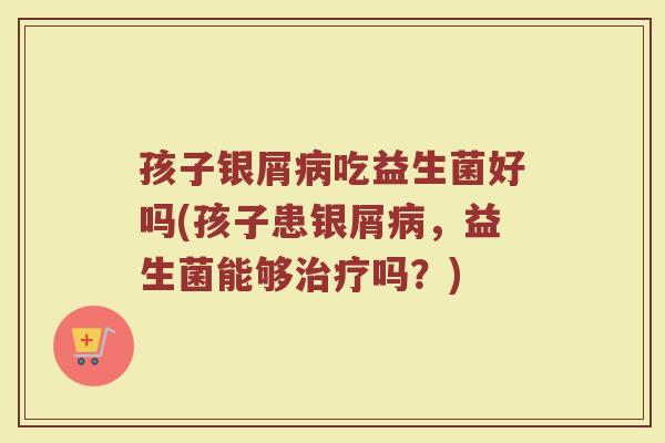 孩子银屑病吃益生菌好吗(孩子患银屑病，益生菌能够治疗吗？)